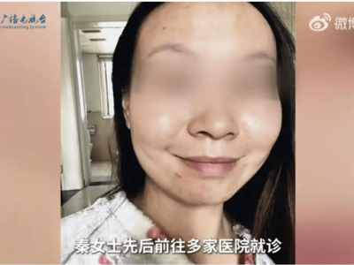可复美陷成分争议，巨子生物市场地位动摇，Ⅲ类医疗器械批文何时能获？