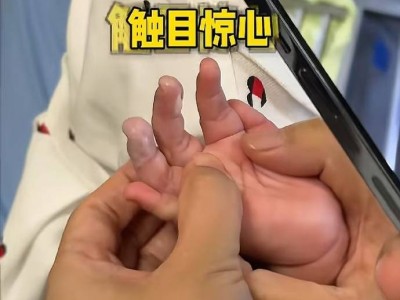 张纪中小女被保姆烫伤，夫妇急送医，保姆失职引众怒