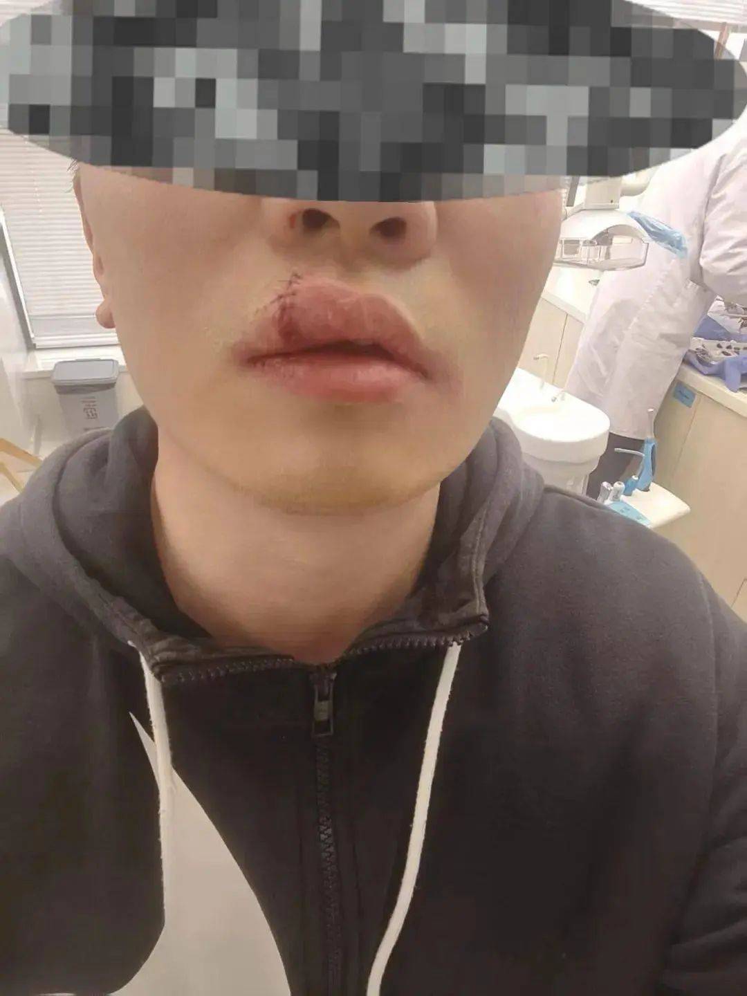 事故现场照片