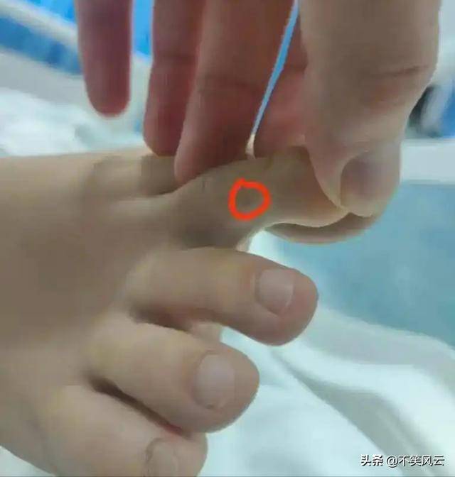 女子伤口照片