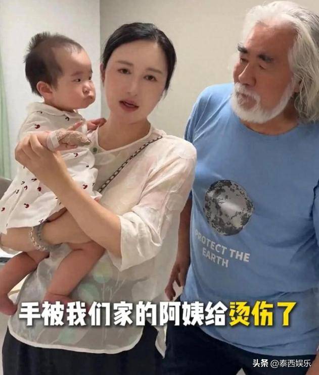 小龙珠烫伤后就医