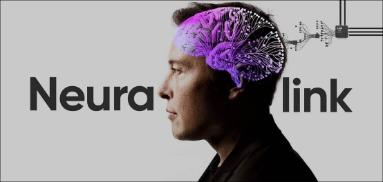 A brief overview of Elon Musk<i></i>'s Neuralink project - a brain implant - Sify