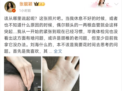 张靓颖健康状况引关注：营养不良、额头血管突起，手掌伸懒腰竟流血？