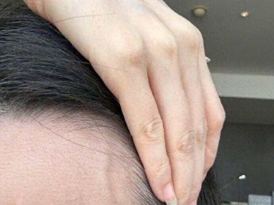 张靓颖健康引关注，自曝体检营养不良，饮食丰富为何还如此？