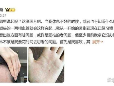 张靓颖健康亮红灯：伸懒腰手掌流血，额头血管突起，坚强面对舞台