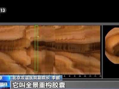 服贸会医疗展区亮点多：AI助力手术与胶囊机器人，开启健康科技新篇章