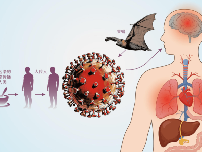 印度尼帕病毒溯源新进展：9只蝙蝠中1只现抗体，生枣椰汁再成焦点
