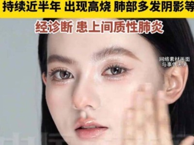 22岁女主播半年喷三百多次定妆喷雾患间质性肺炎 医生：雾化成分入肺易引发炎症